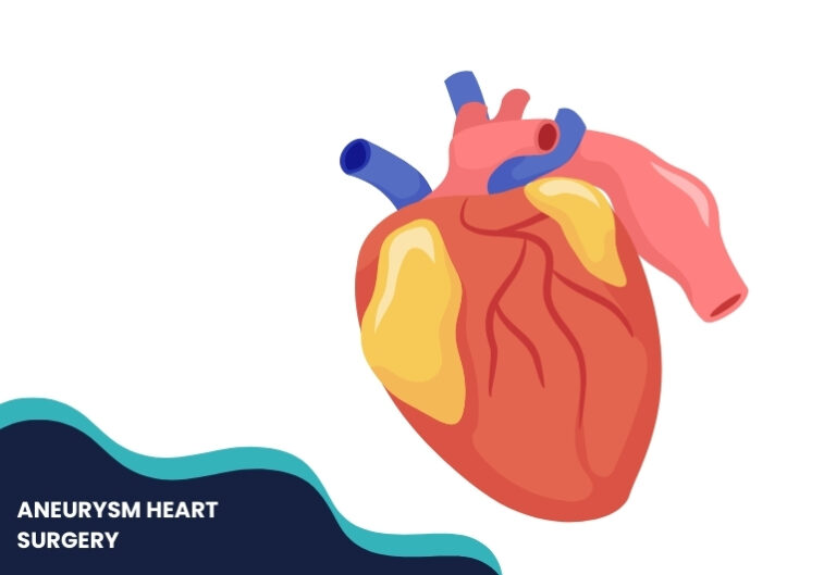 ANEURYSM HEART SURGERY | Dr. Harish Badami Best Cardiologist